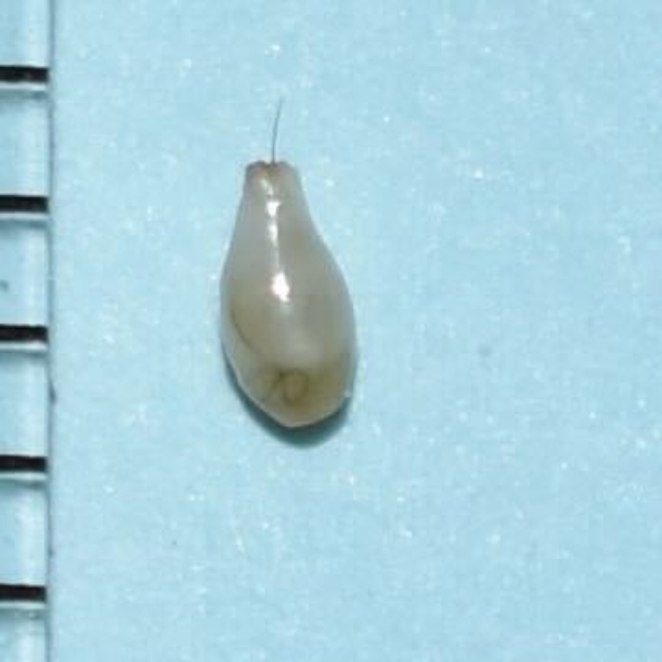 摘出したコメドno3