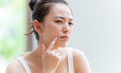 「もう治らないかも」とニキビを諦めかけている人