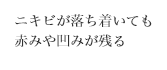 ニキビが落ち着いても
赤みや凹みが残る